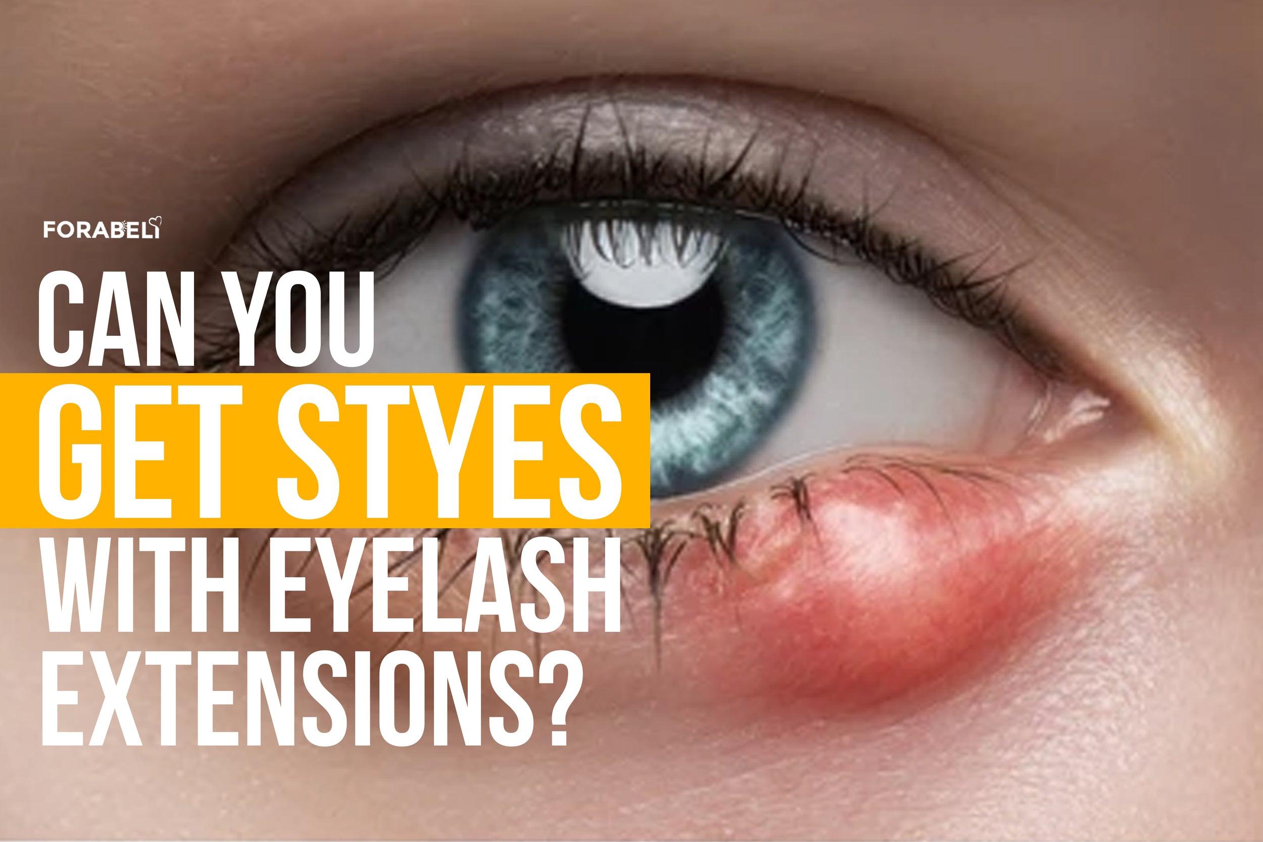 should i remove my eyelash extensions if i have a stye