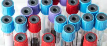 Choosing The Right Blood Collection Tubes