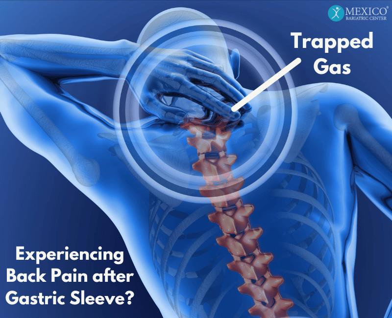 Experiencing back pain after gastric sleeve