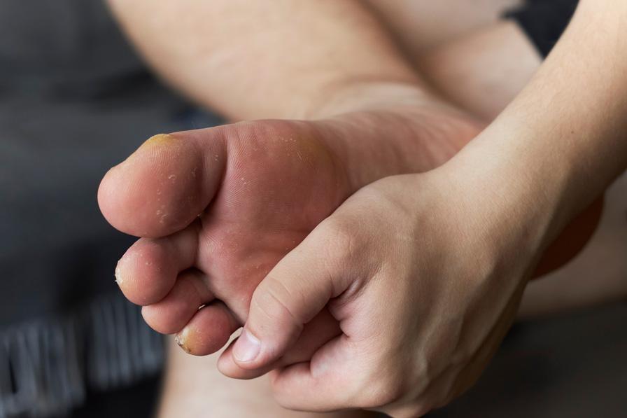 what is the difference between a callus and a bunion